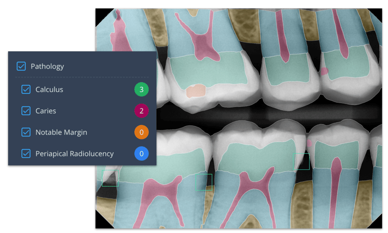 Automated Analysis for Images with Pearl AI